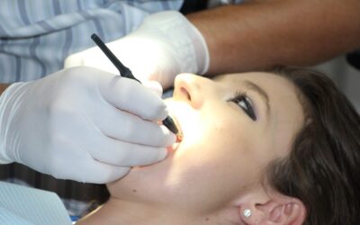 Hojení zubního implantátu krok za krokem