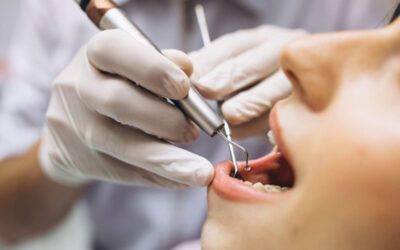 Endodoncie, nebo implantát? Které řešení je pro vás lepší?