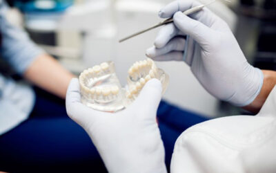 Zubní implantáty vs. korunky: Jak si vybrat to správné řešení