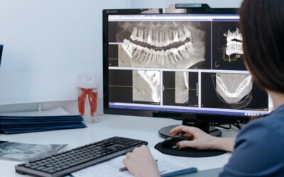 Nejčastější mýty o zubech z Turecka – a jak je vyvrátit