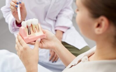 Zubní můstek, nebo implantát? Kdy je co vhodné a proč